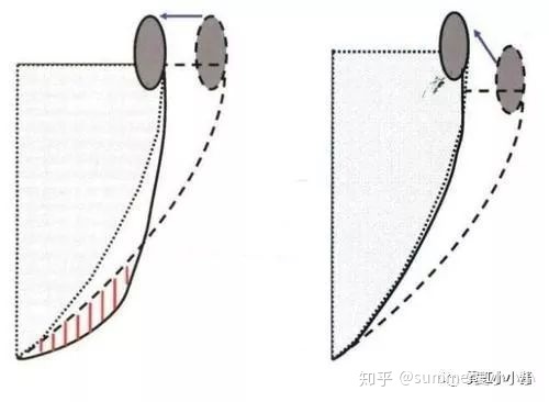 男人额头窄颧骨宽面相_男人颧骨高额头窄面相_颧骨高下颌角宽额头窄面相