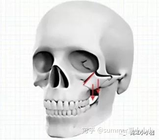 男人颧骨高额头窄面相_男人额头窄颧骨宽面相_颧骨高下颌角宽额头窄面相