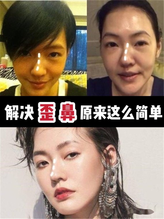 笑时嘴歪的女人面相_嘴歪女人的面相好吗_男人嘴歪的人面相婚姻