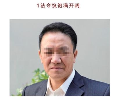 
易道风水命理法令纹的相学意义及破解方法！