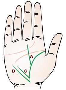 手相算命生命线短表示此人重病体质衰弱的或早死亡