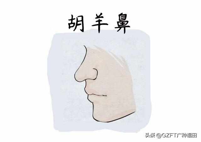 鼻梁上有痣代表着什么？男人鼻准鼻梁健康命运