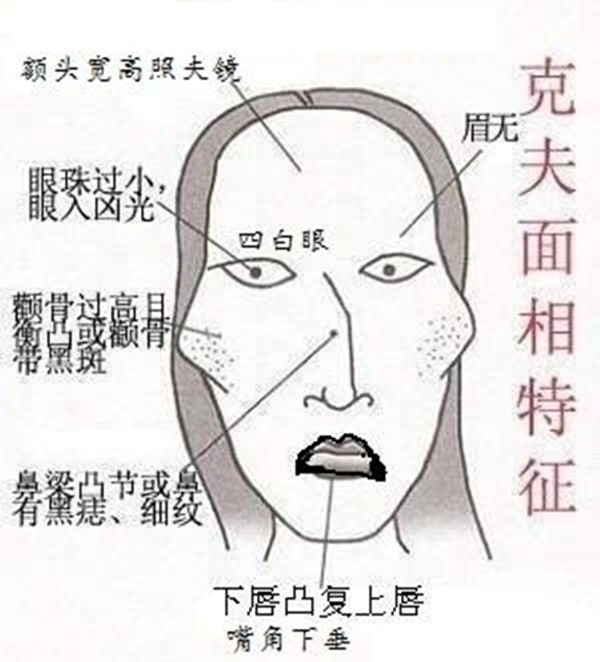 一生注定要离婚的面相