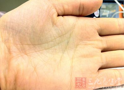 女性左手手心突然长痣代表了什么?(1)_科学探索(组图)