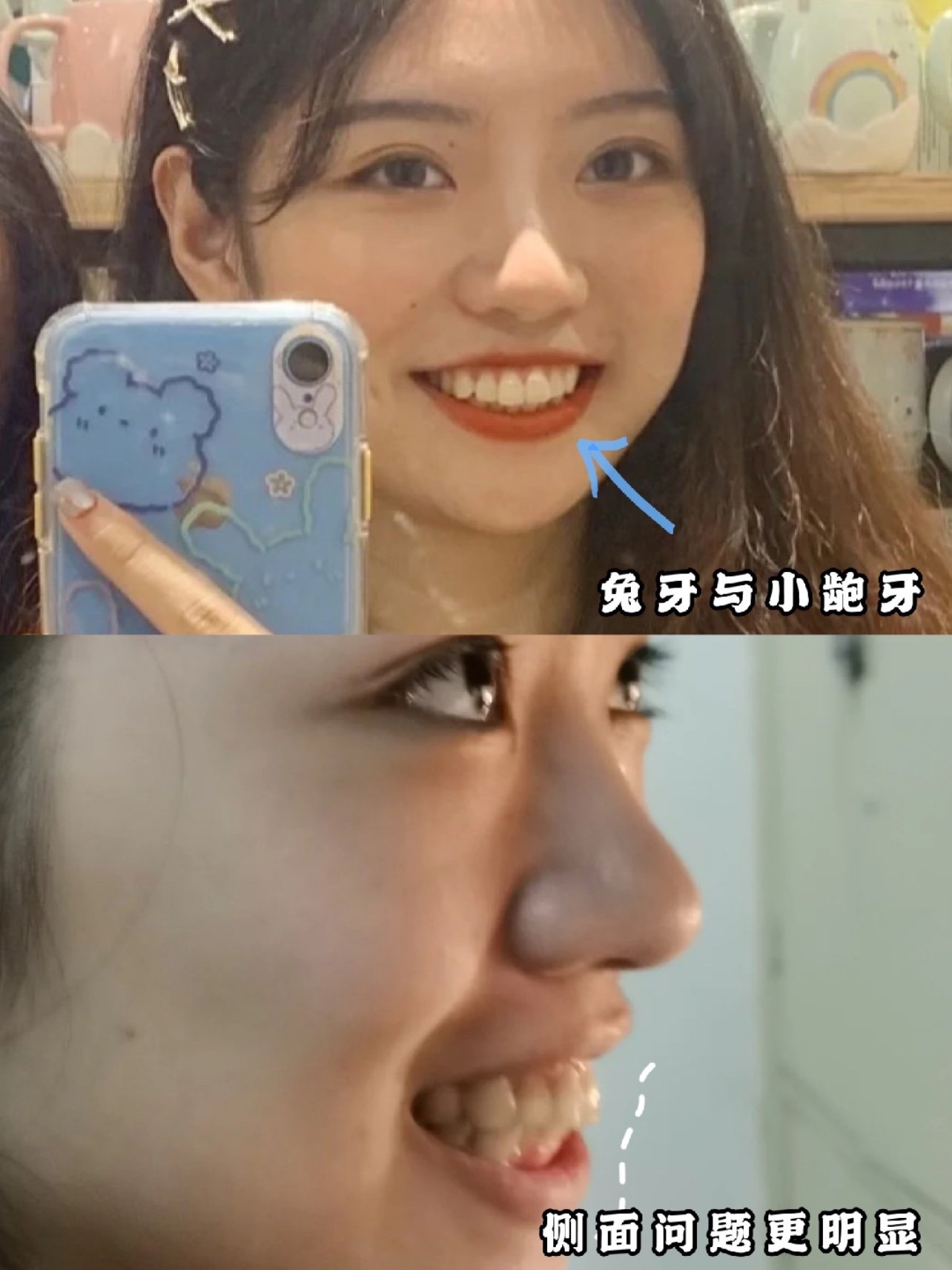 门牙有缝的女人旺夫？女人的门牙有缝吗吗？