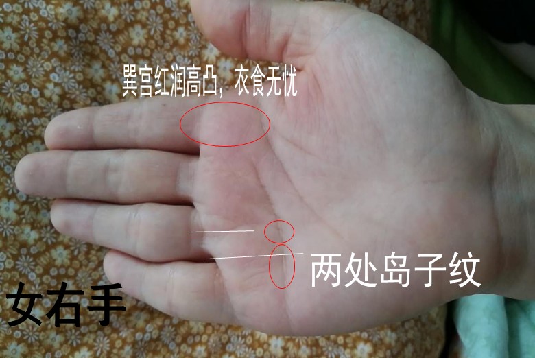 （李向东）手相上的岛纹，你知道吗？