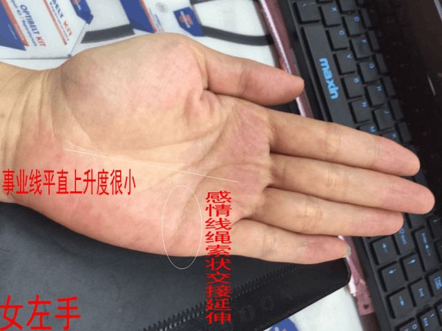 （李向东）手相上的岛纹，你知道吗？