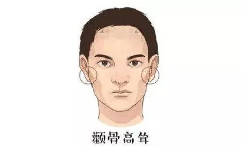 男生颧骨高的面相上怎么说？男生面有哪些特点？