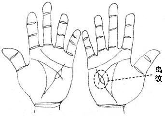 岛纹出现在食指下方，预示财运出现问题！