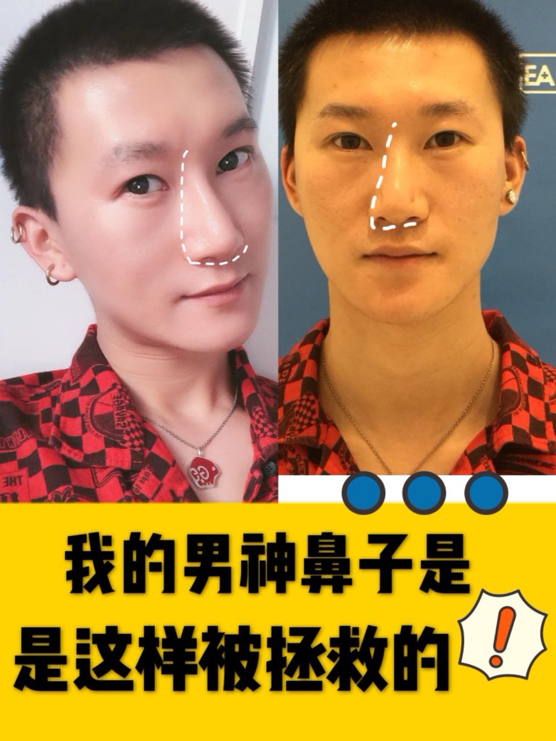 面相角度观察，天生命苦的女人有哪些特征？