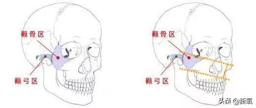 超模大表姐颧骨对气质的影响，你知道吗？